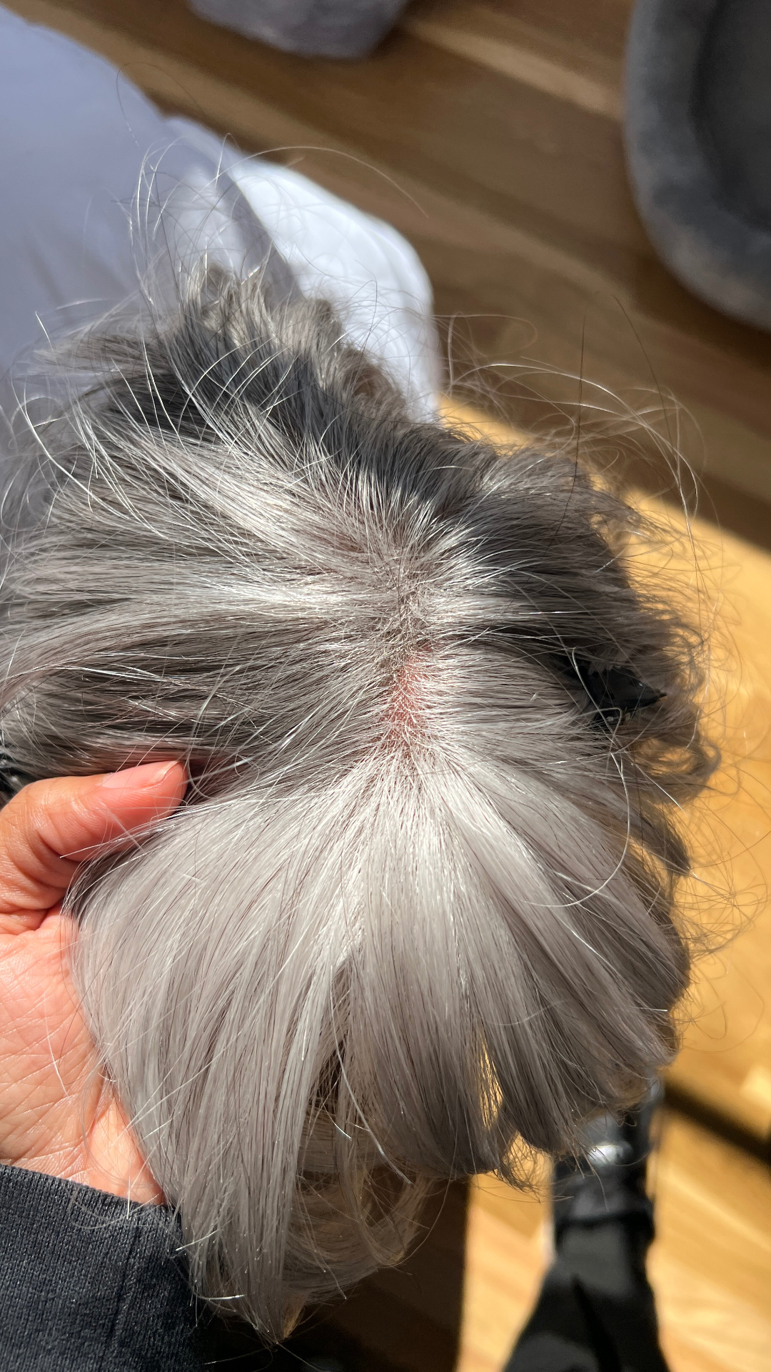 Medical wig